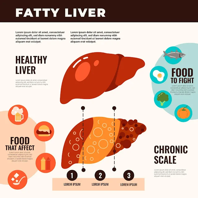 Fatty liver causes