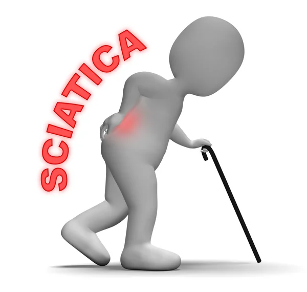 Sciatica causes and symptoms