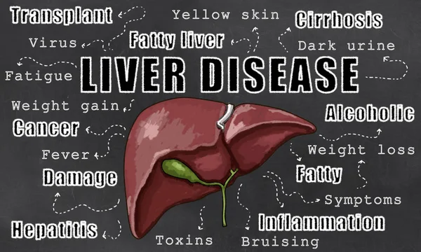 Signs of liver disease