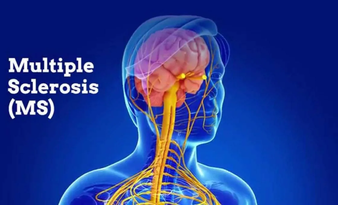 Multiple sclerosis symptoms