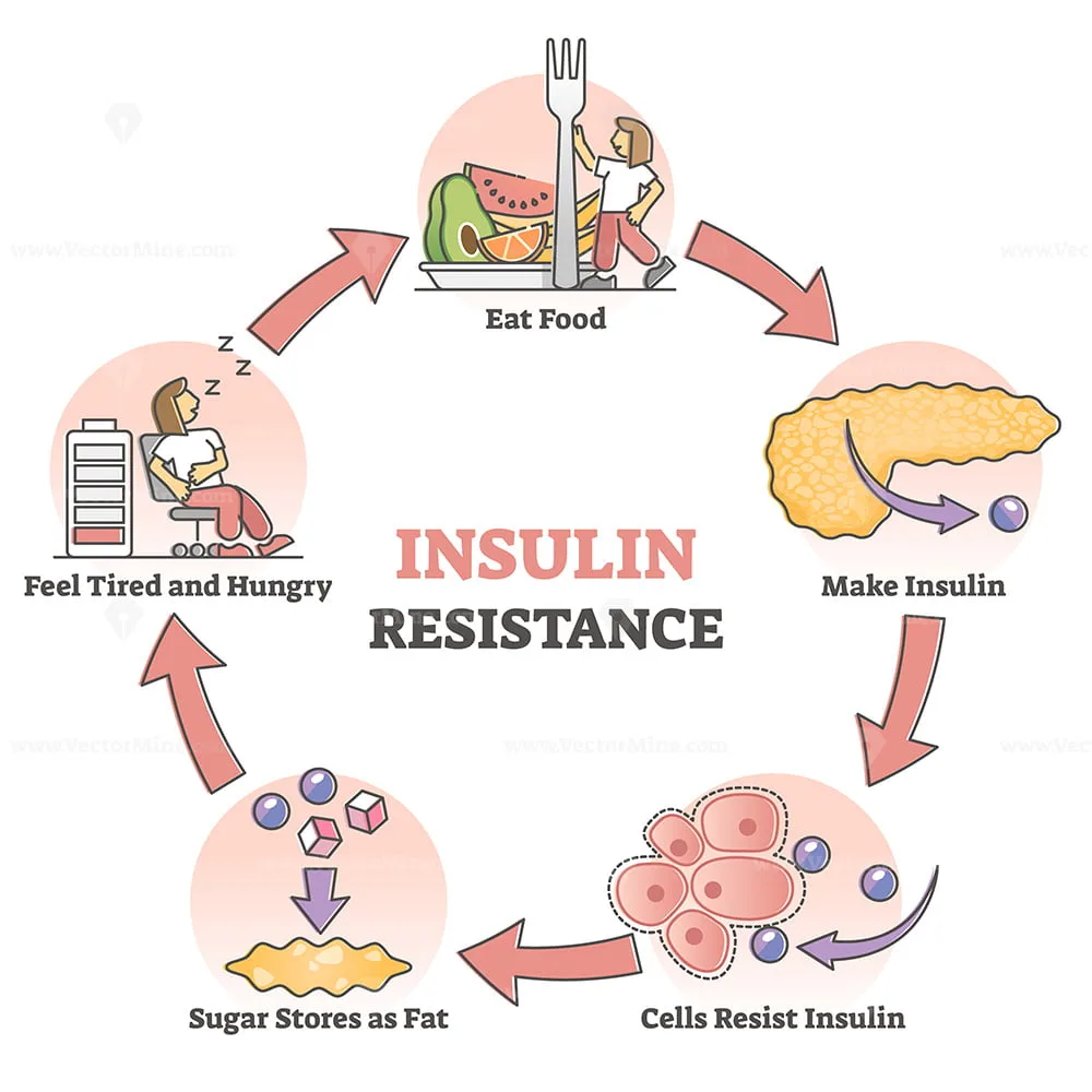 Insulin resistance and Gut bacteria