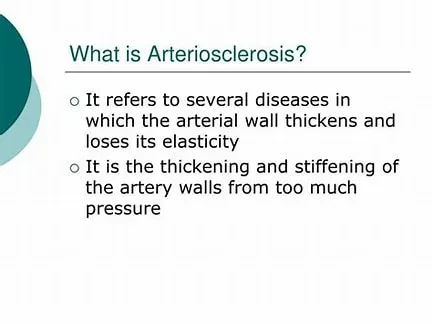 Understanding Arteriosclerosis